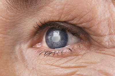 Southeast Eye Group | Contact Lens Exams, Comprehensive Eye Exams and Macular Degeneration